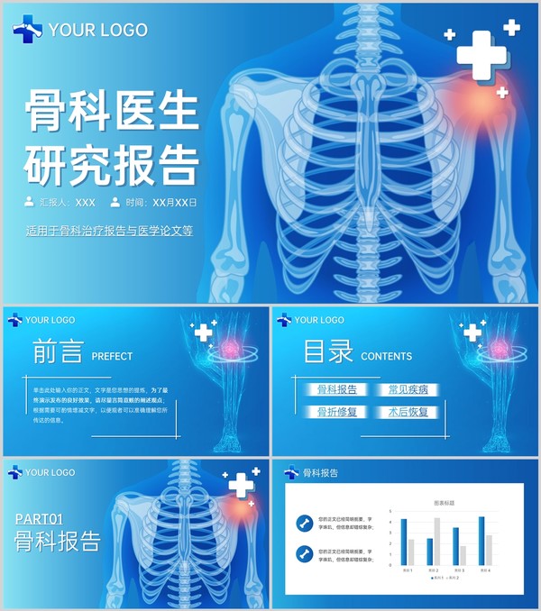 蓝色简洁骨科医生治疗研究报告医学论文答辩PPT模板